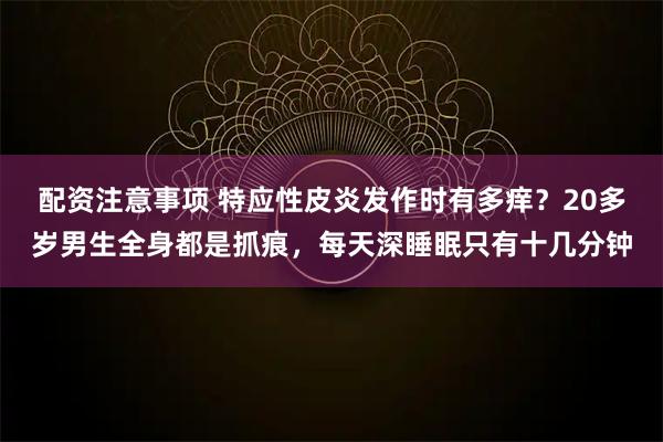 配资注意事项 特应性皮炎发作时有多痒？20多岁男生全身都是抓痕，每天深睡眠只有十几分钟